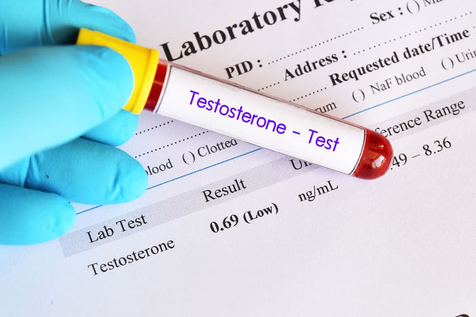 10 Signs Of Low Testosterone And How To Treat It